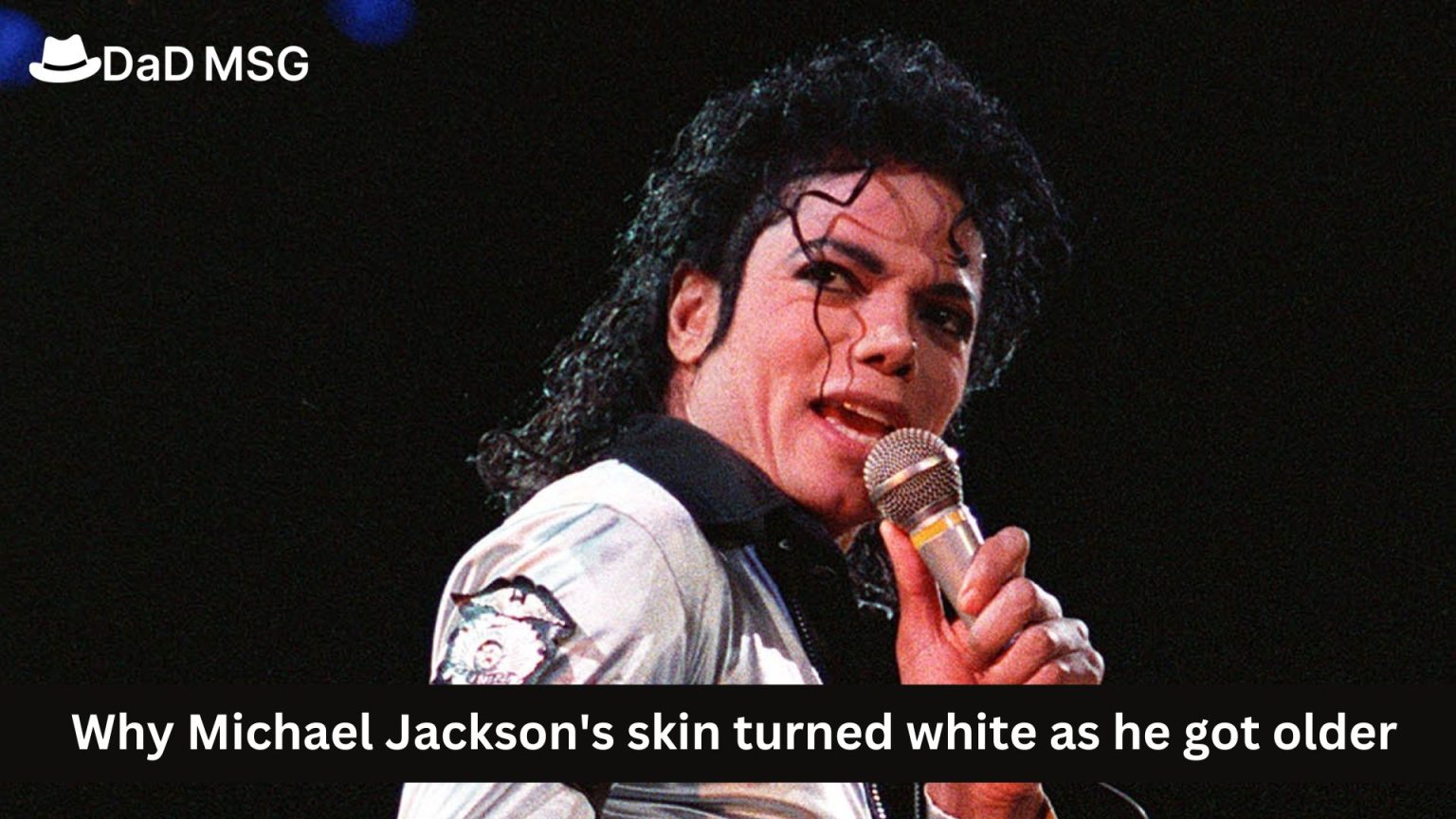 Unraveling the Enigma of Michael Jackson 's Skin Transformation: The Complicated Role of Skin disorder, Autoimmune Disorders, and Cultural Pressures on the King of Pop's Appearance and Health